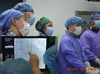 经导管主动脉瓣置换术 不用开刀治疗主动脉瓣重度狭窄